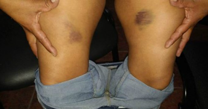 Polic&iacute;a viol&oacute; a compa&ntilde;era con un palo de escoba